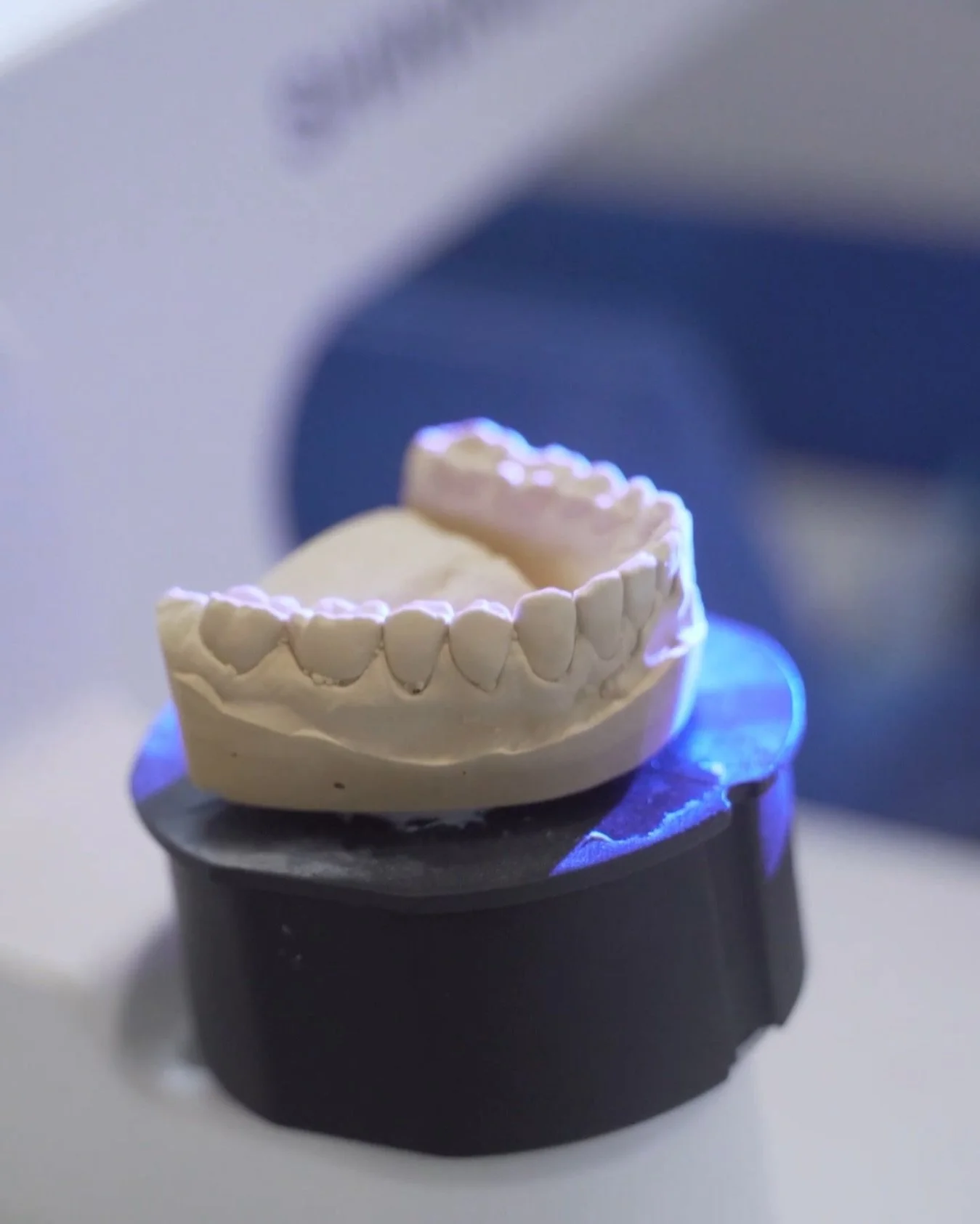 Precision starts here.
Every restoration begins with accuracy - from scan to smile. 🦷✨