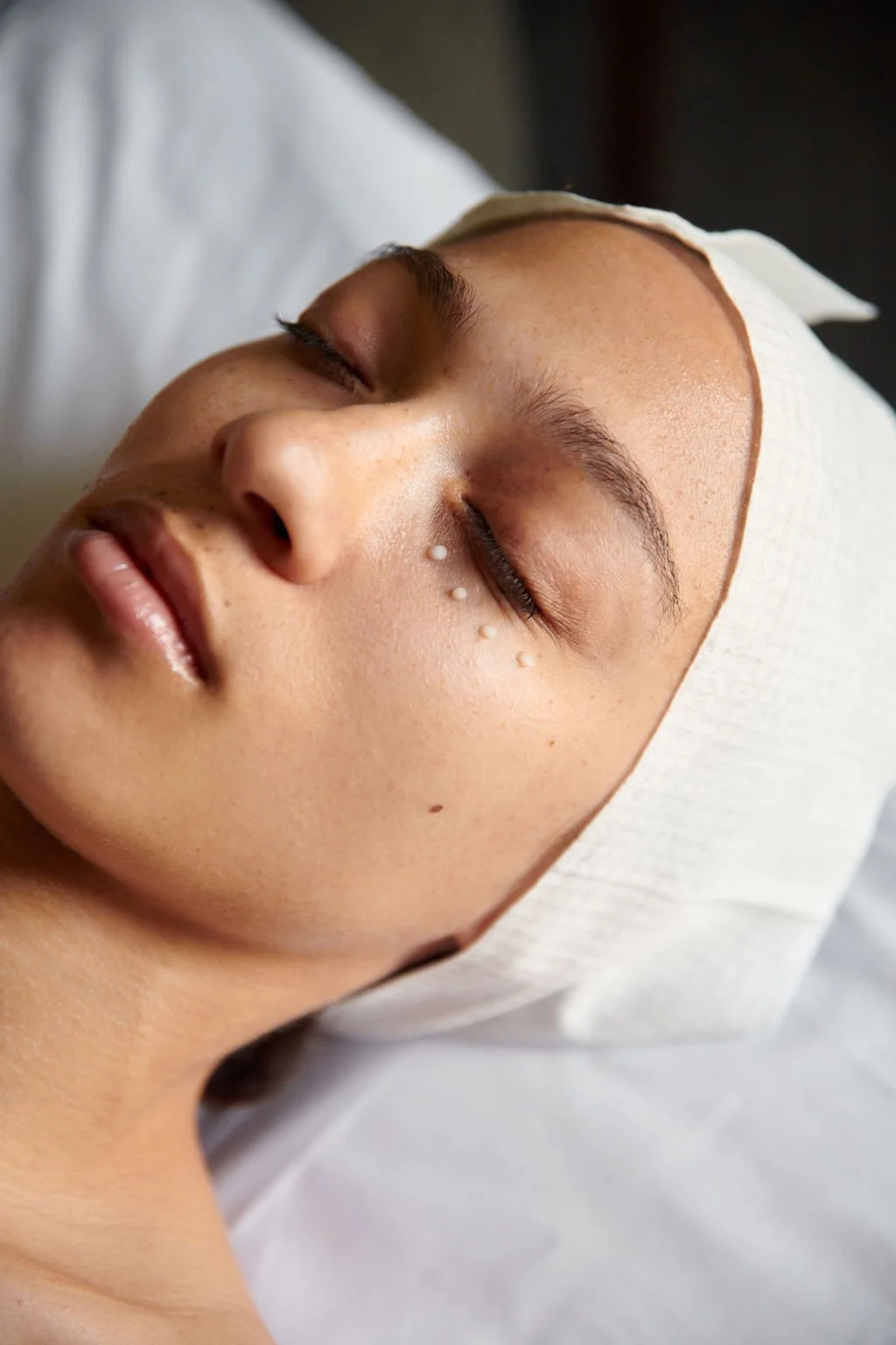Nano Needling vs. Microneedling: What’s the Difference?