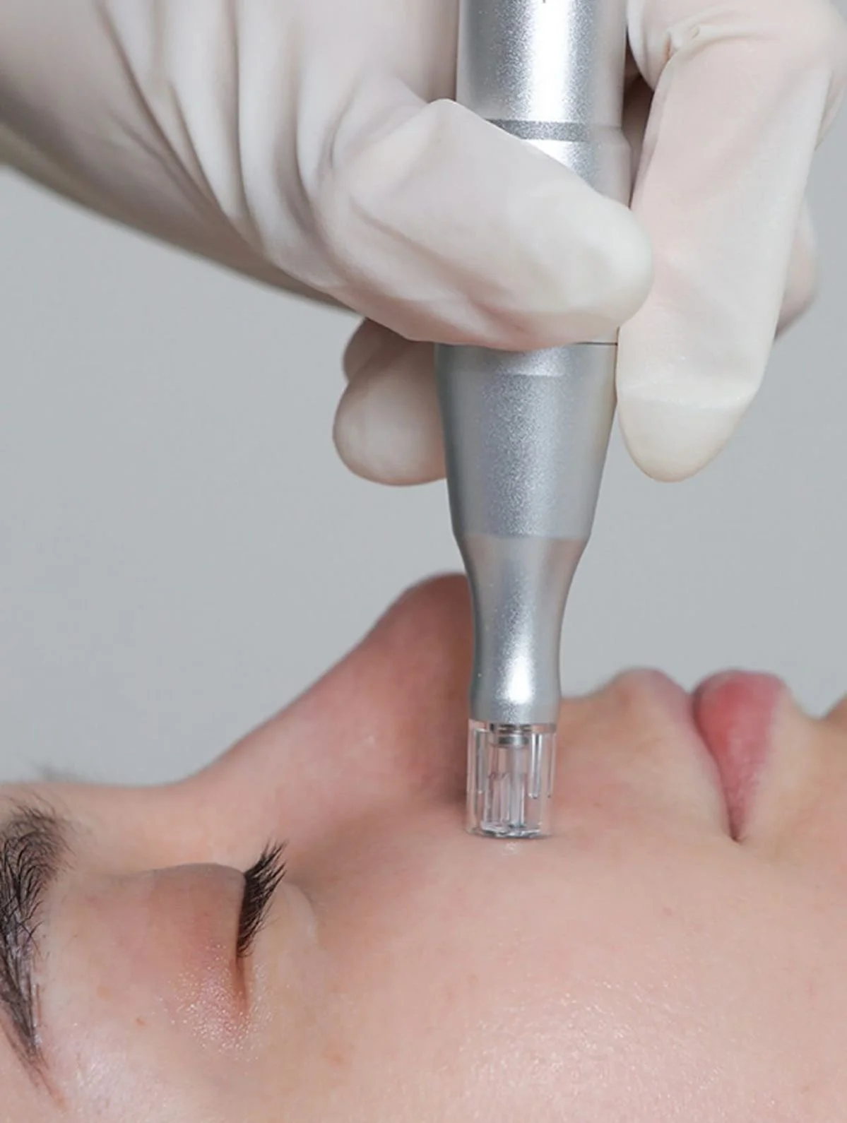 Microneedling vs. Nano Needling: What’s the Difference — and Which One Is Right for You?