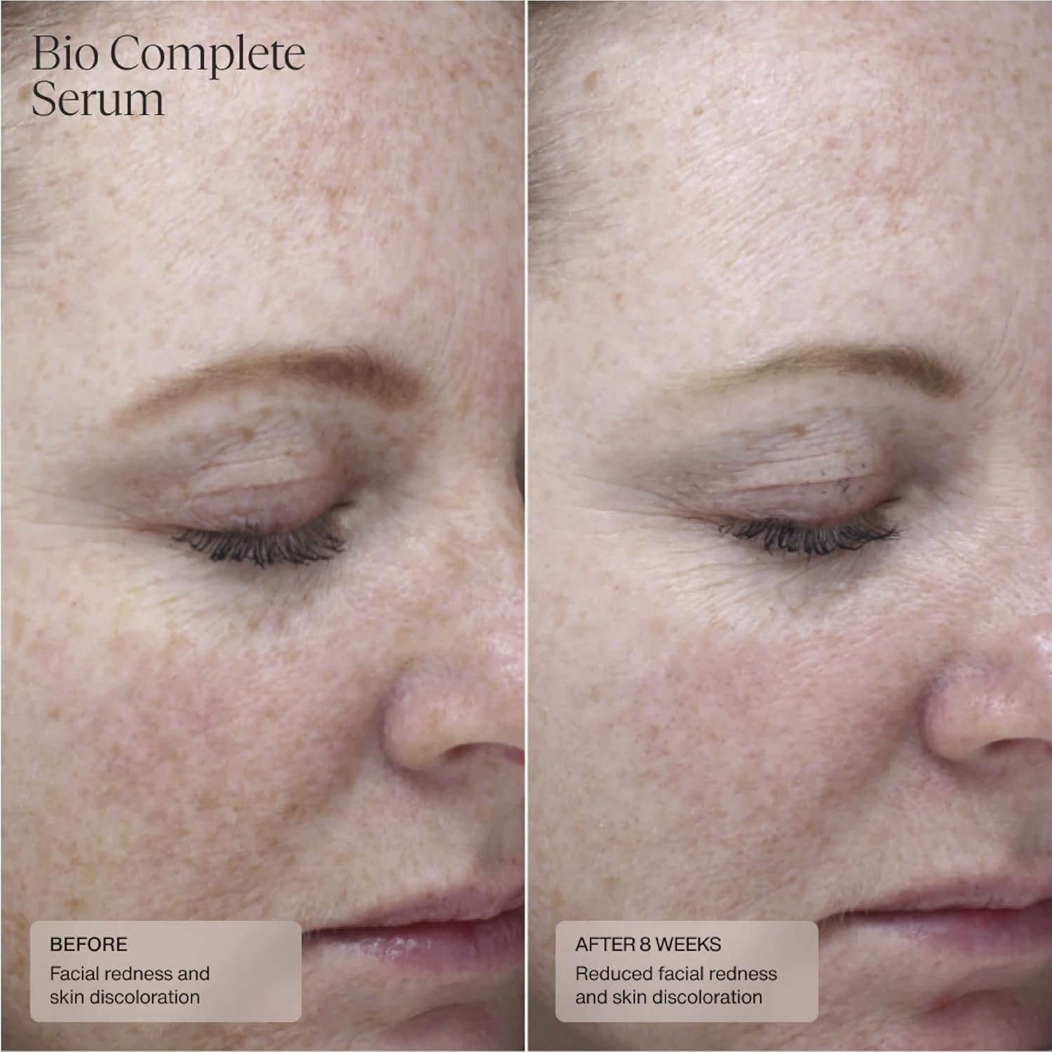 Sente Bio Complete Serum03.jpg