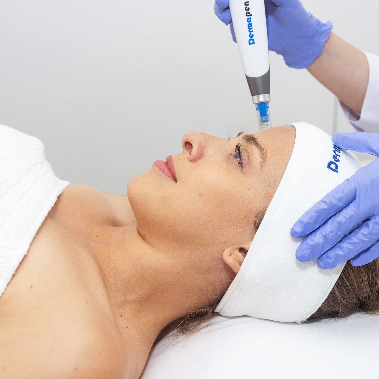 Dermapen-4-Promo-26-1500px.jpg