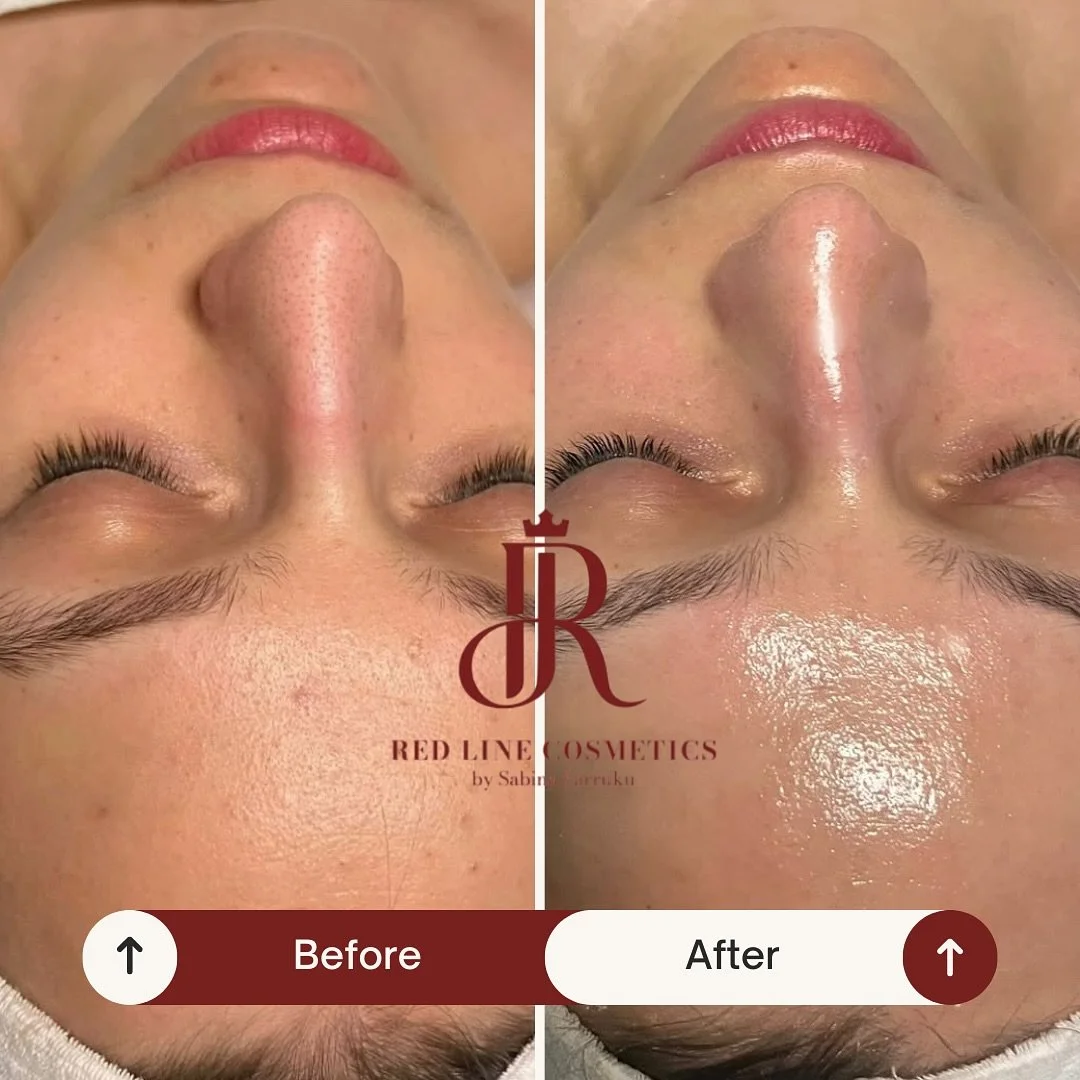 Frische, strahlende Haut nach einer Gesichtsbehandlung ✨
Die Behandlung unterst&uuml;tzt die Hauterneuerung, spendet Feuchtigkeit und sorgt f&uuml;r einen gesunden Glow. 💆&zwj;♀️
Tipp: Regelm&auml;&szlig;ige Behandlungen sind das Geheimnis langfrist