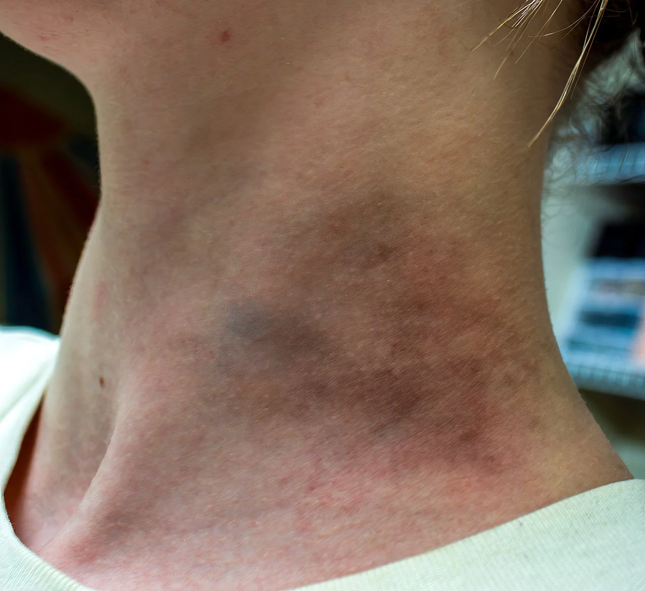 Neck2-Edit.jpg