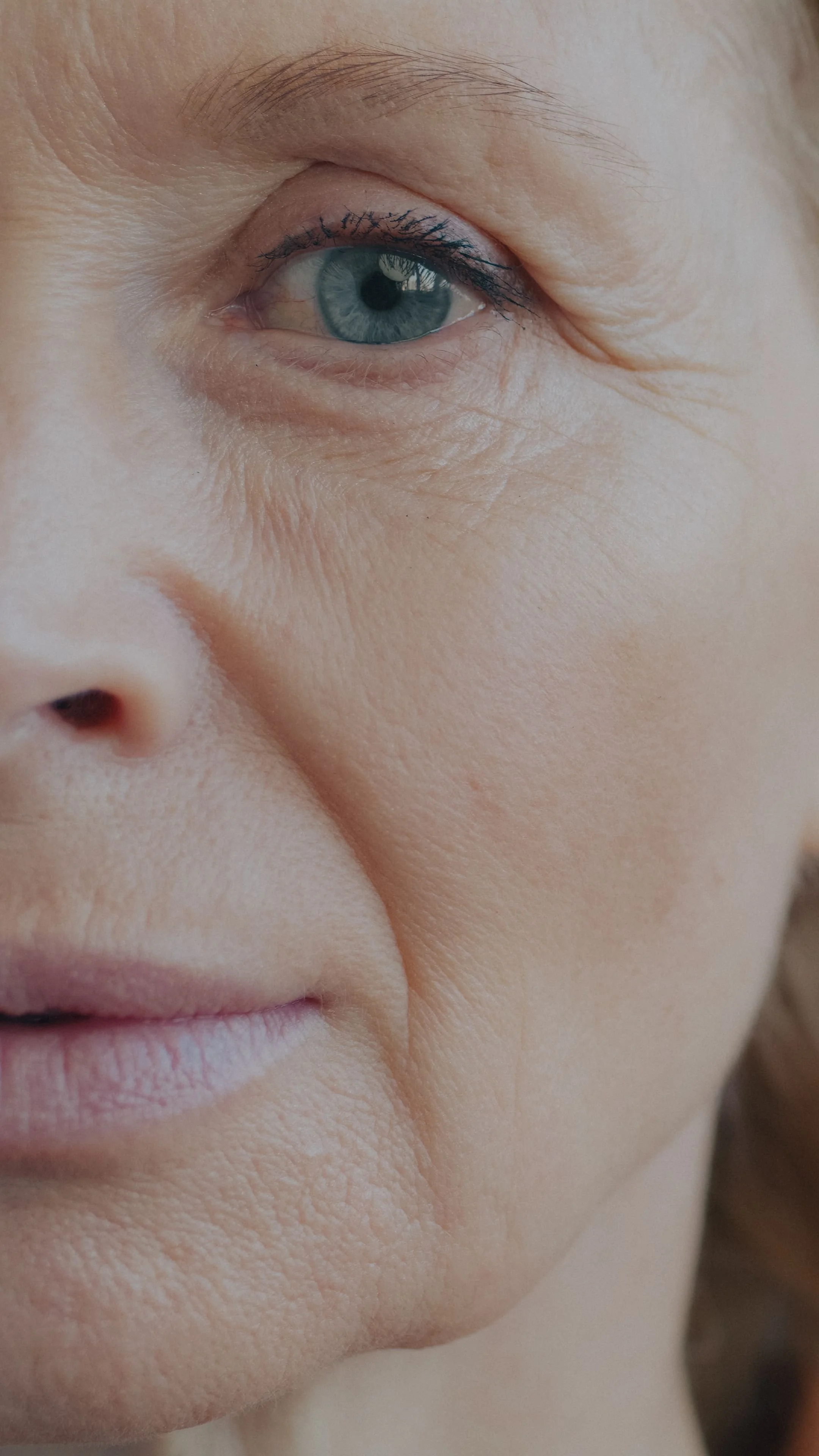 Skin tightening : XERF, Sofwave, Thermage, Morpheus… Encore une nouvelle machine miracle ?