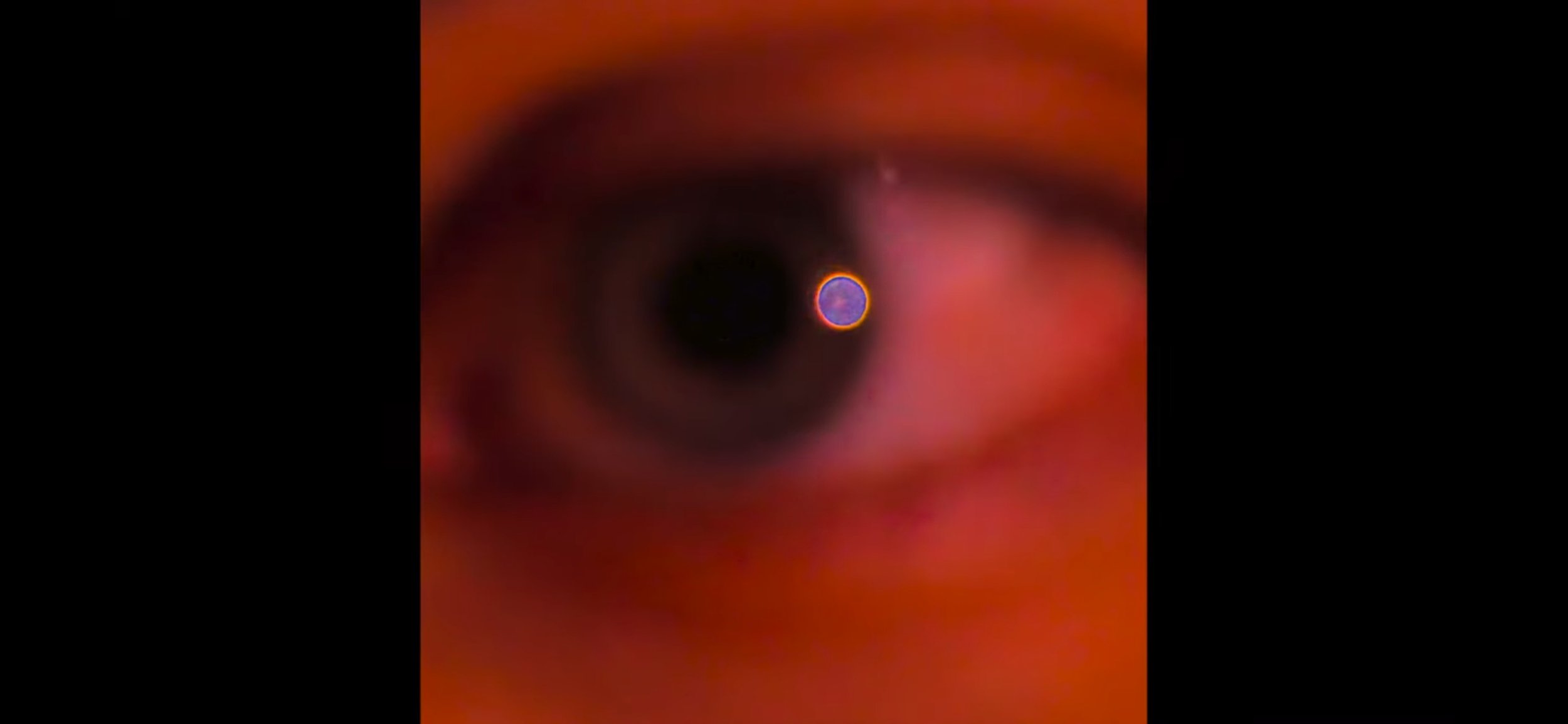 Close-up of a human eye with a glowing, purple spot on the iris, surrounded by a dark background.