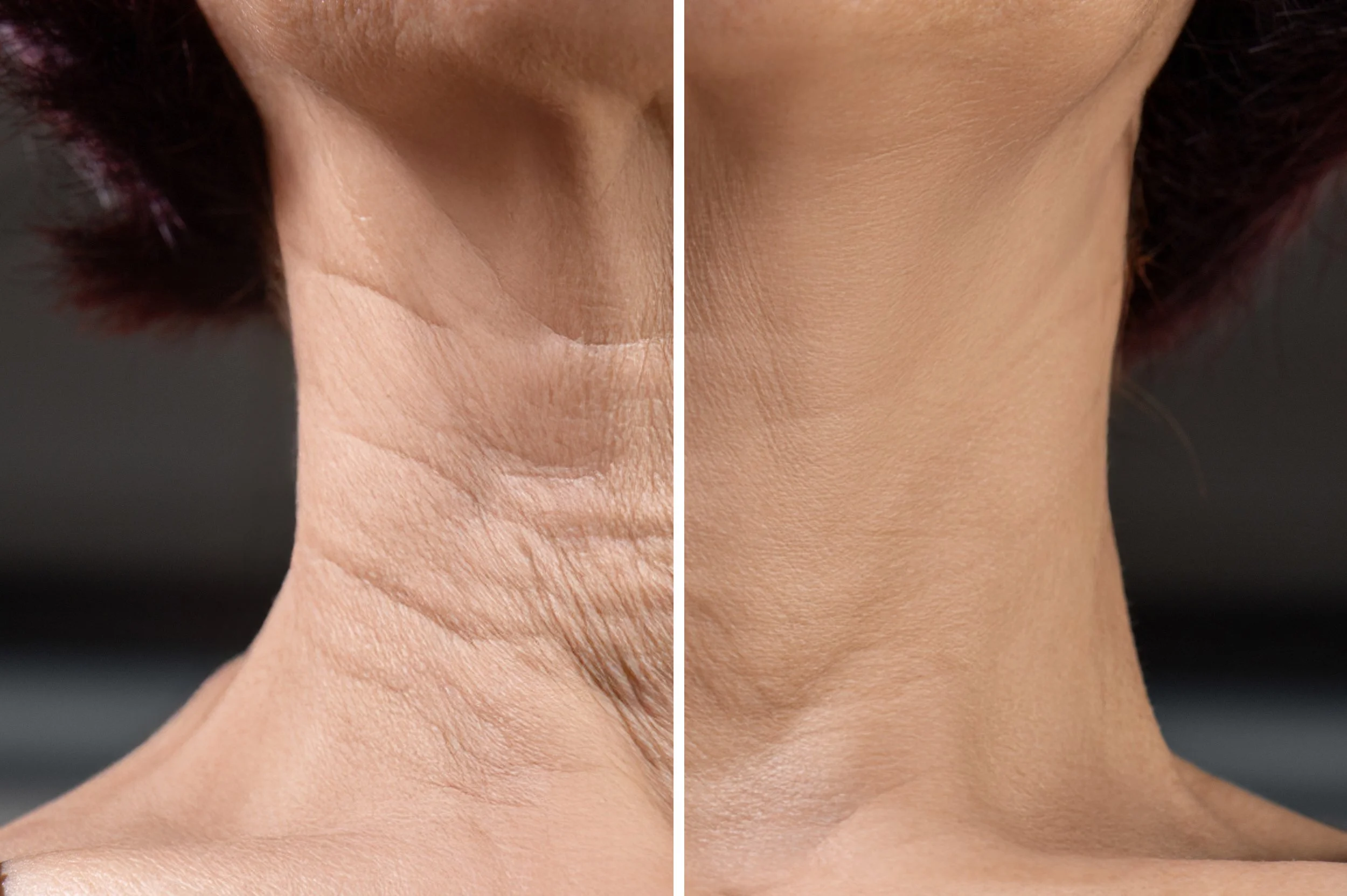 neck02.jpg