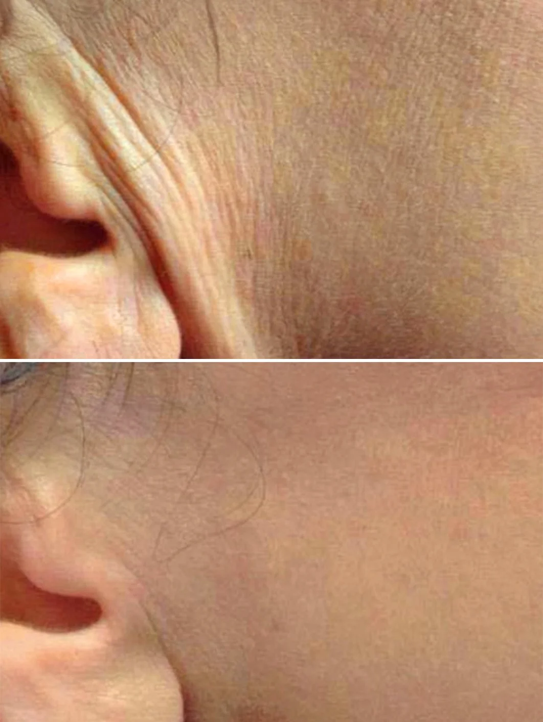 Ear.jpg