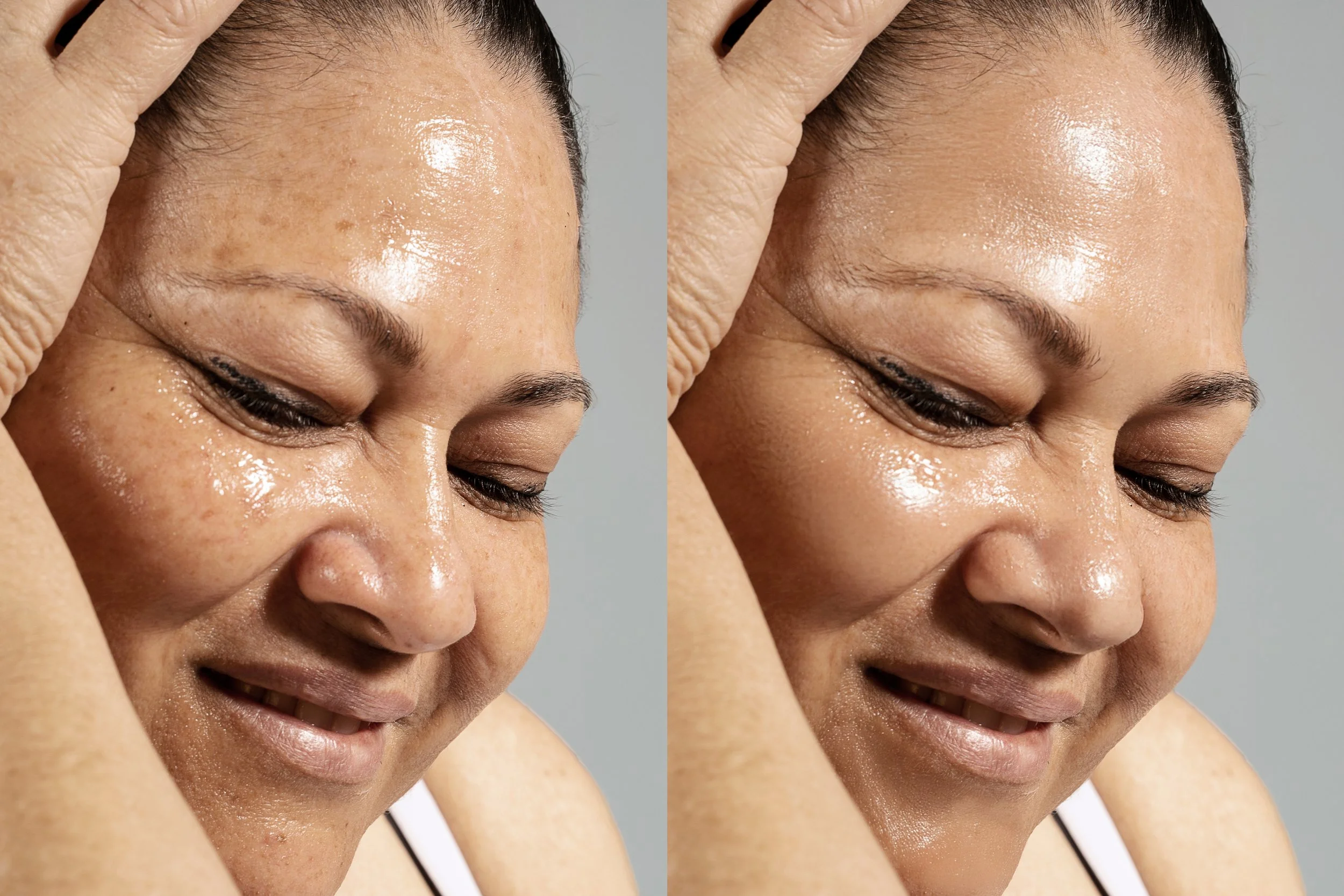 Sun Damage.jpg