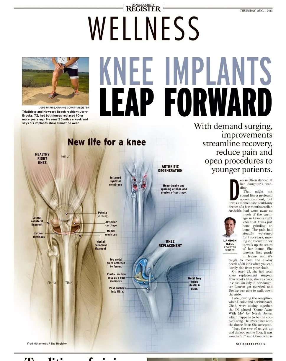 KneeImplants01.jpg