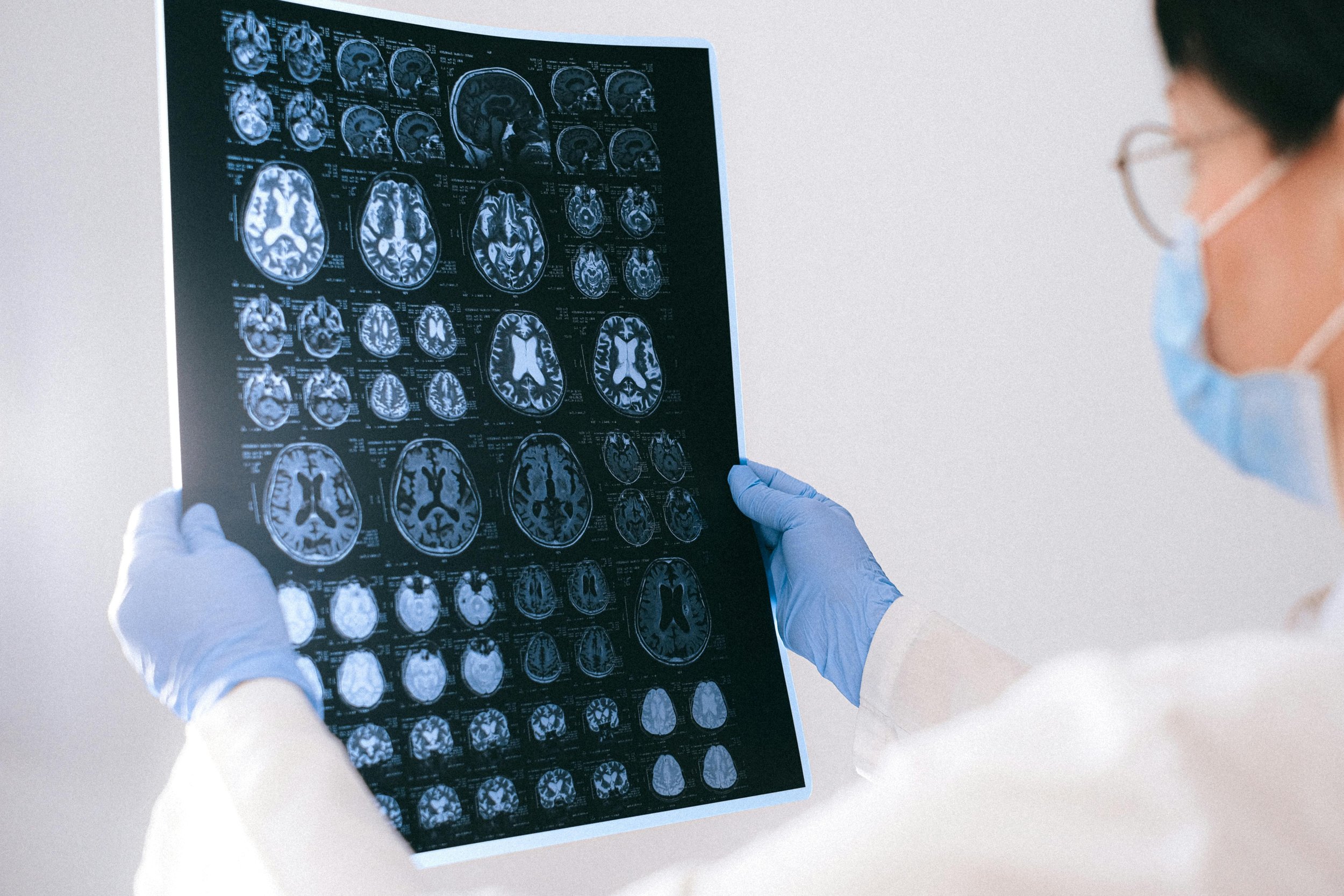 Alzheimer’s vs. Dementia: What’s the Difference? | Attainable Care Solutions — Jacksonville, FL