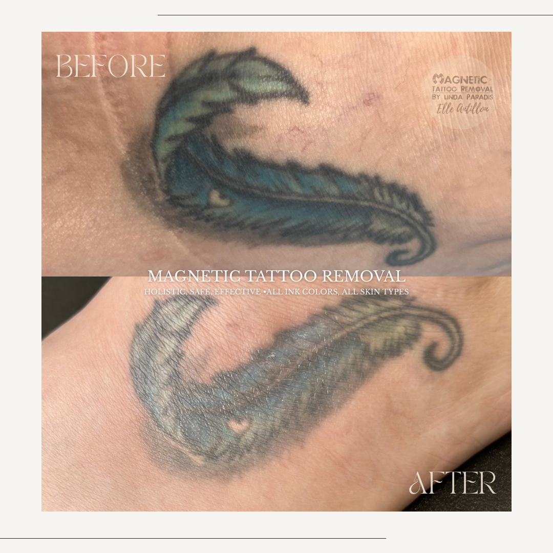 HEALED Body tattoo | Multicolored feather pigment comparison, desired desaturation in 1 Session