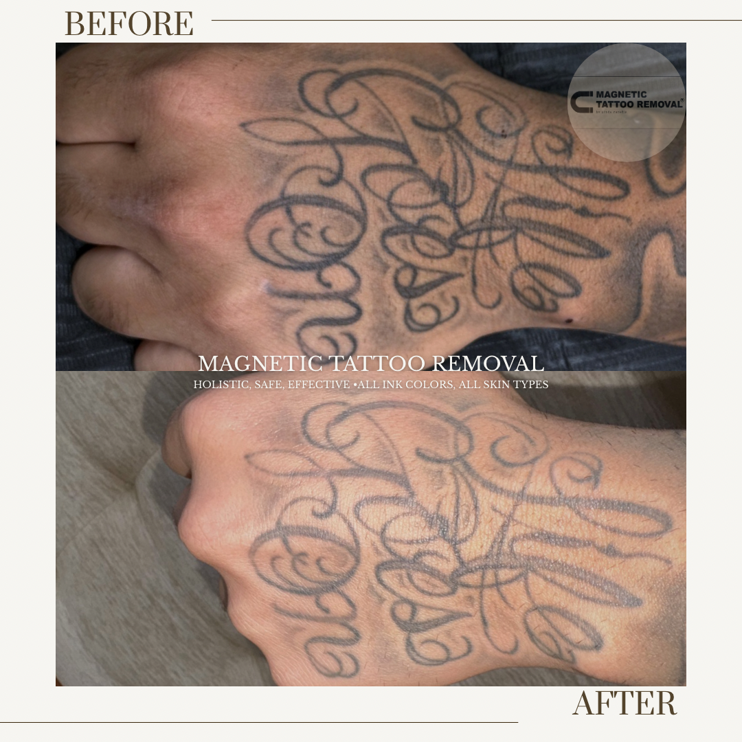 HEALED 2 Sessions | Fading over-saturated black line work to grey wash