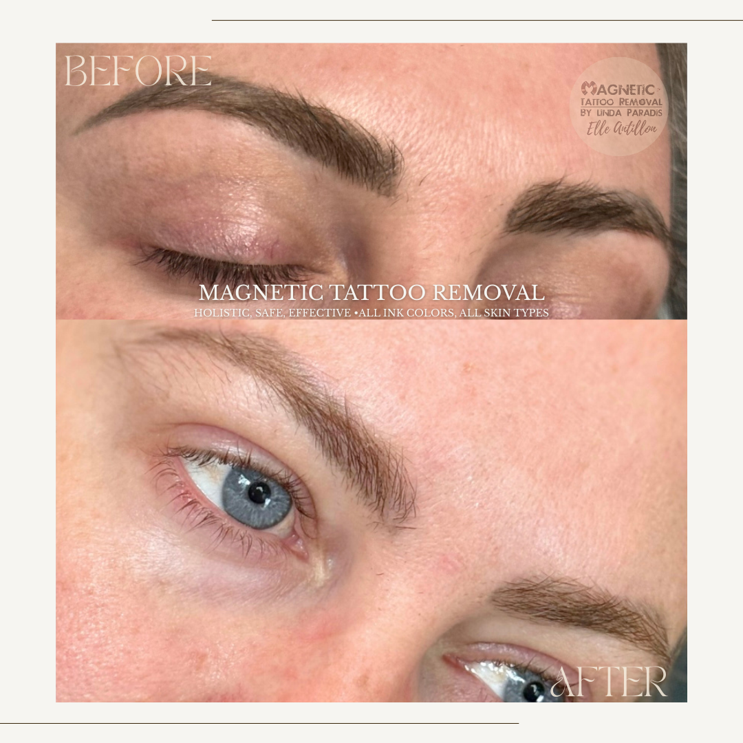 HEALED 3 Sessions Removal on Eyebrows permanent makeup | Before-and-after comparison of brow pigment. 