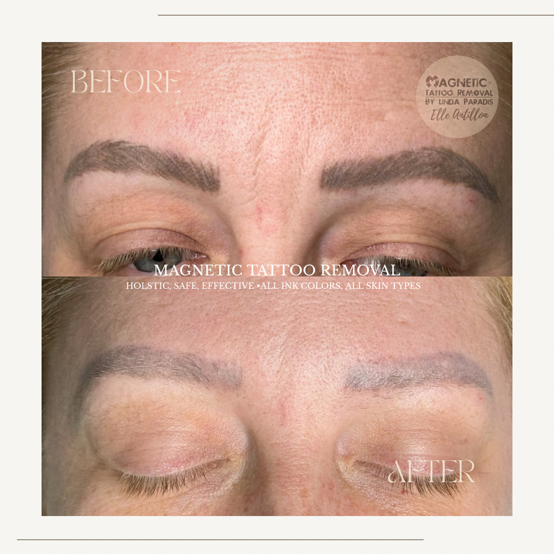 Healed 4 Sessions removal on Eyebrow permanent makeup | Before-and-after comparison of brow pigment.