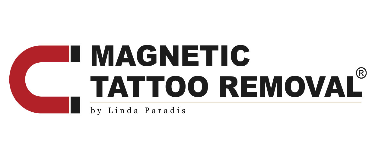 Las Vegas Magnetic Tattoo Removal at LVRA