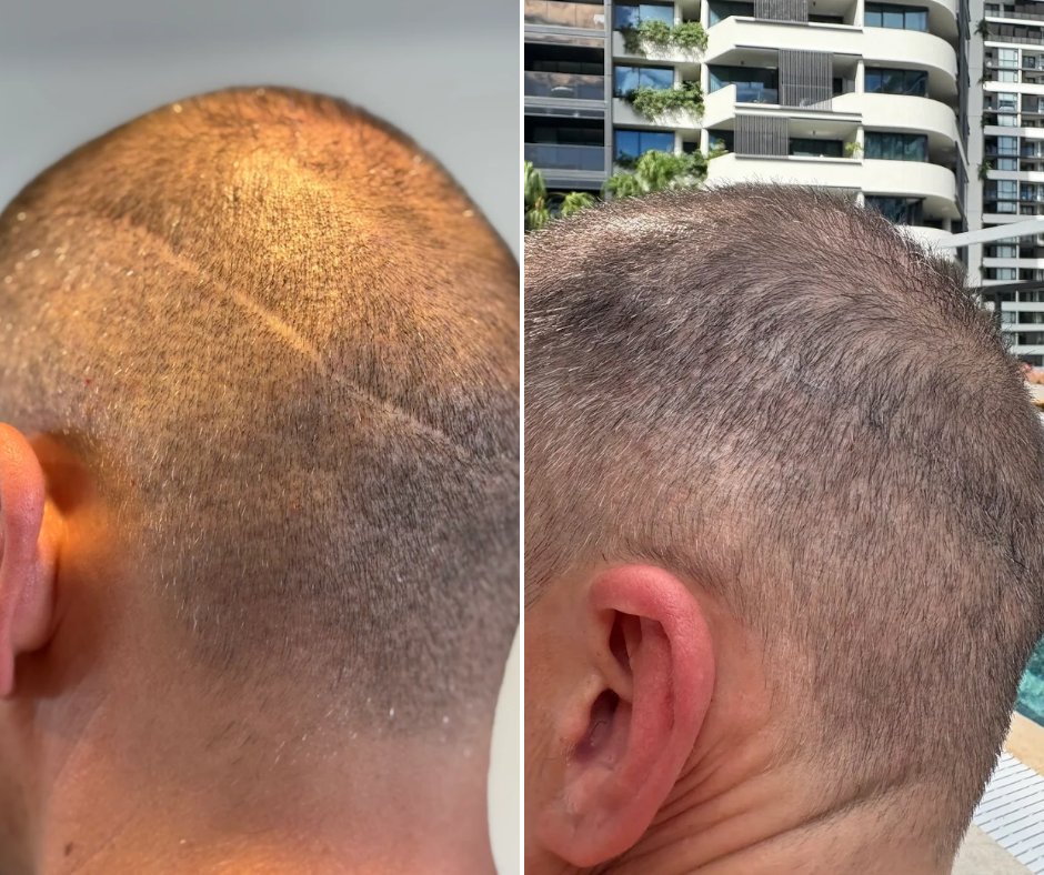 Untitled design (75).png