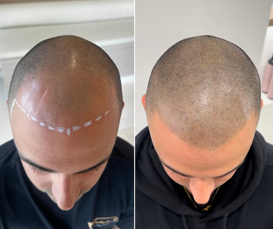 ON POINT SMP WEBSITE IMAGES (1).png