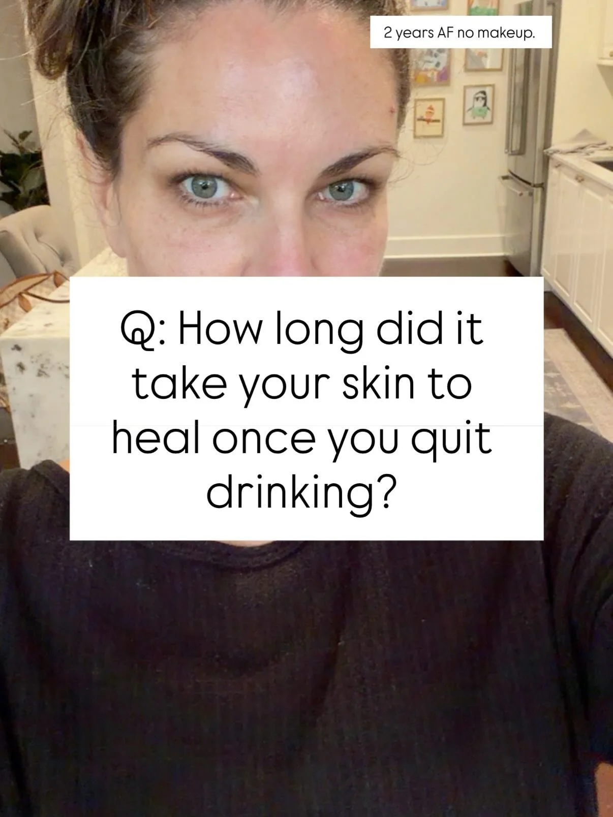 8 healthy skin habits that I began the day I quit drinking:

1. Take a probiotic. I never did this until I quit. The gut controls the skin. Alcohol destroys the gut. 

2. Wash my face with actual cleanser and not a lazy face wipe no matter what!!! Th