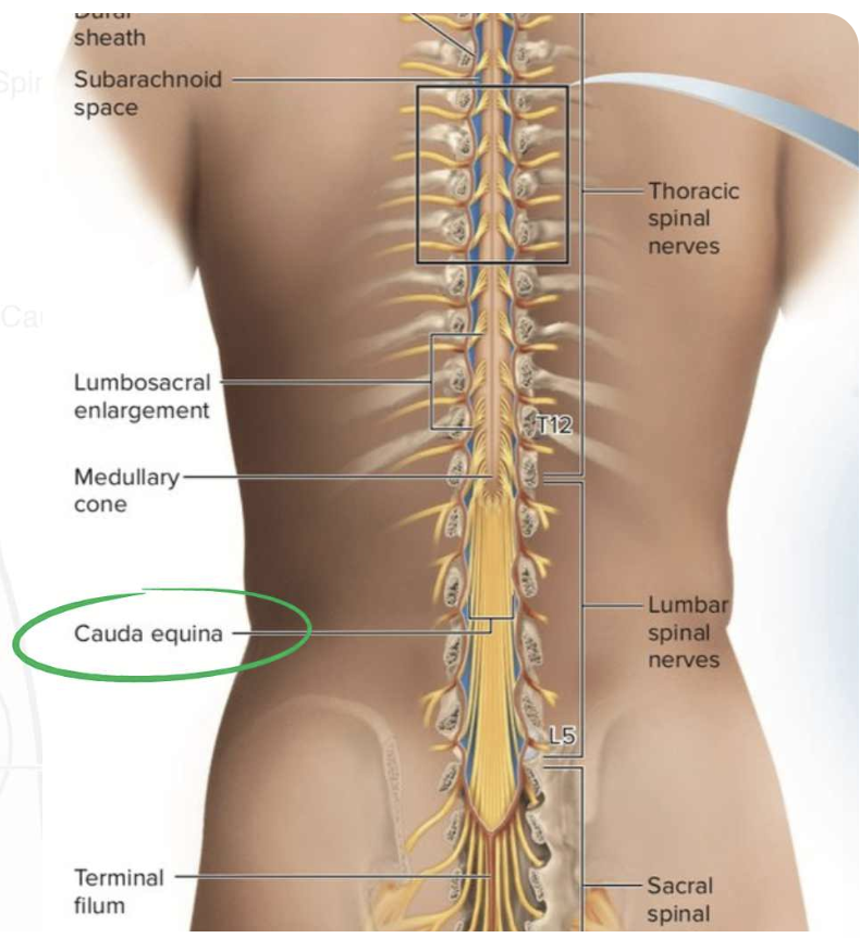 Cauda Equina Syndrome: Symptoms, Treatment, and what to do after the emergency