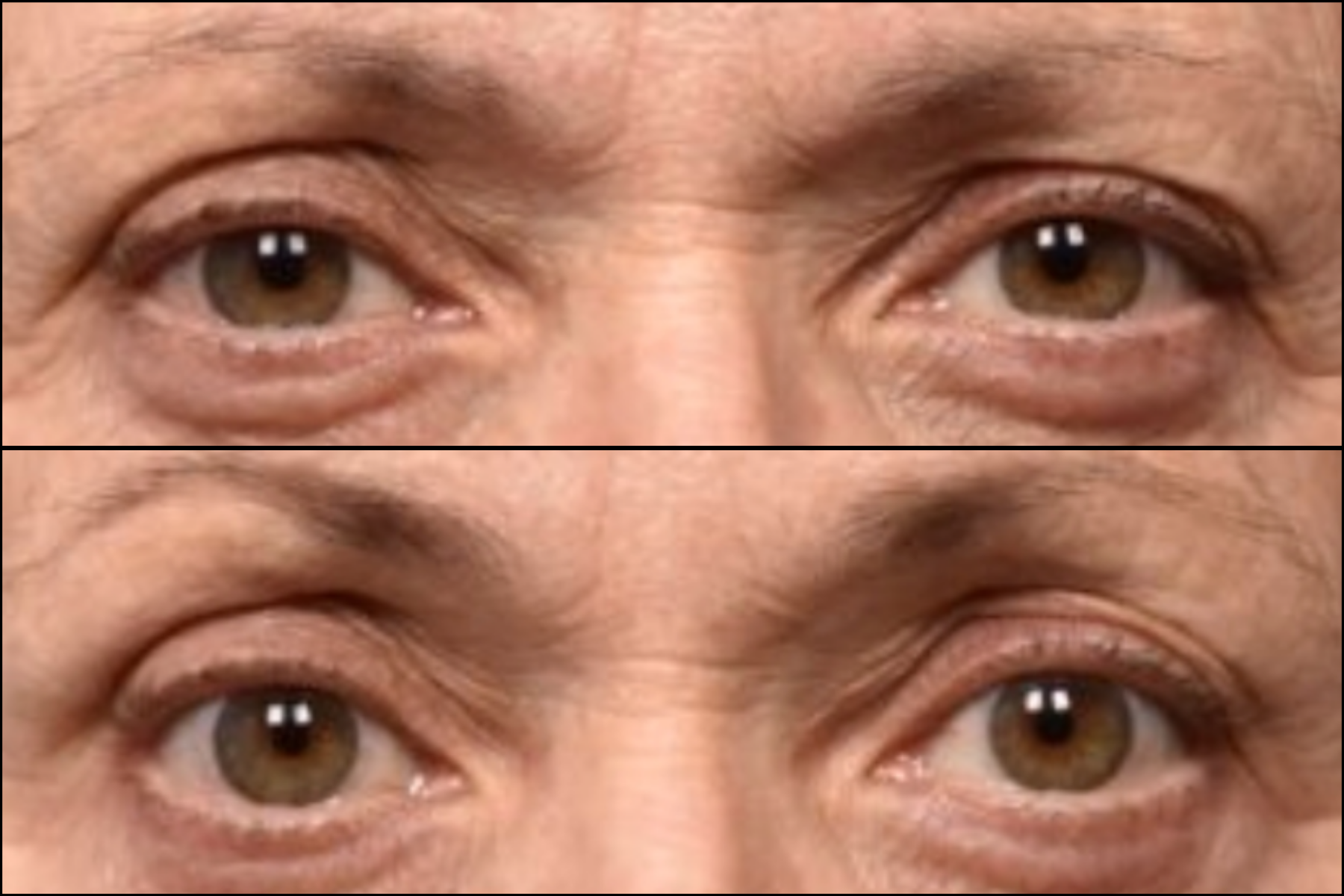 Copy of Sofwave B&A.png