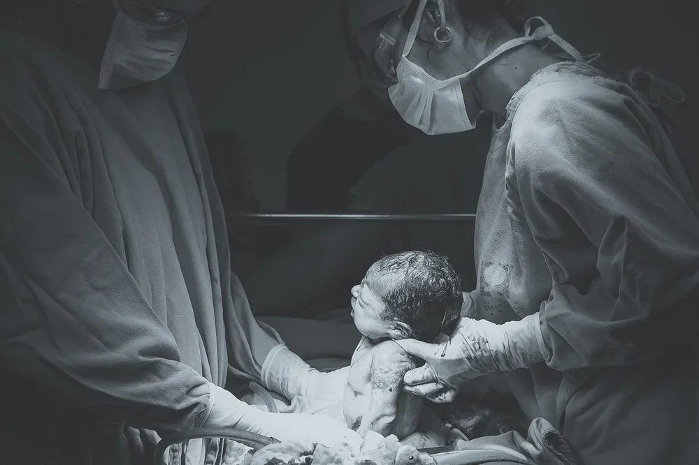 Preparing for an elective caesarean