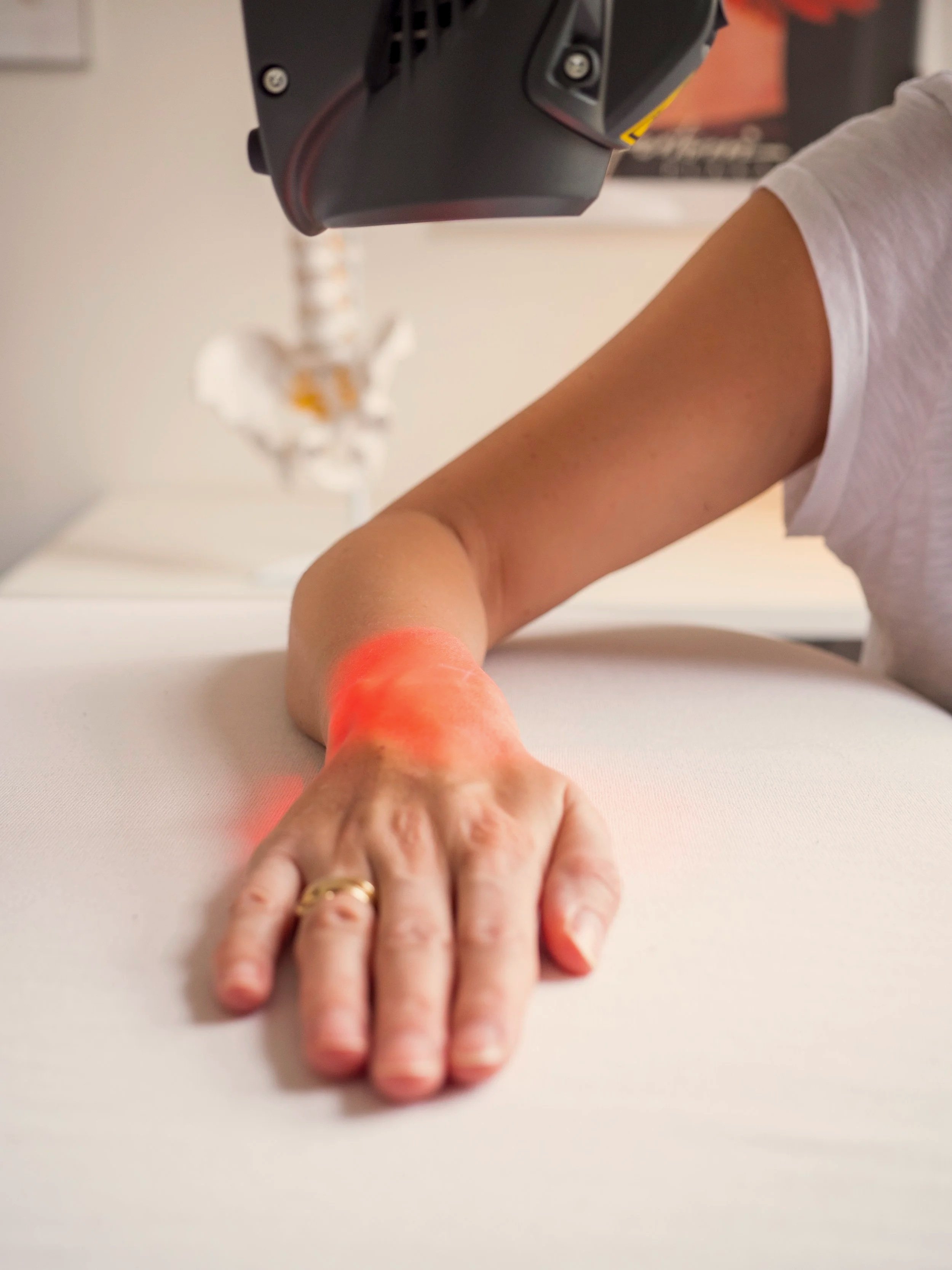 En kvinde arm med ringe på fingrene hvid baggrund med en hvid t-shirt - kvindens håndled får rødt laserlys på sig