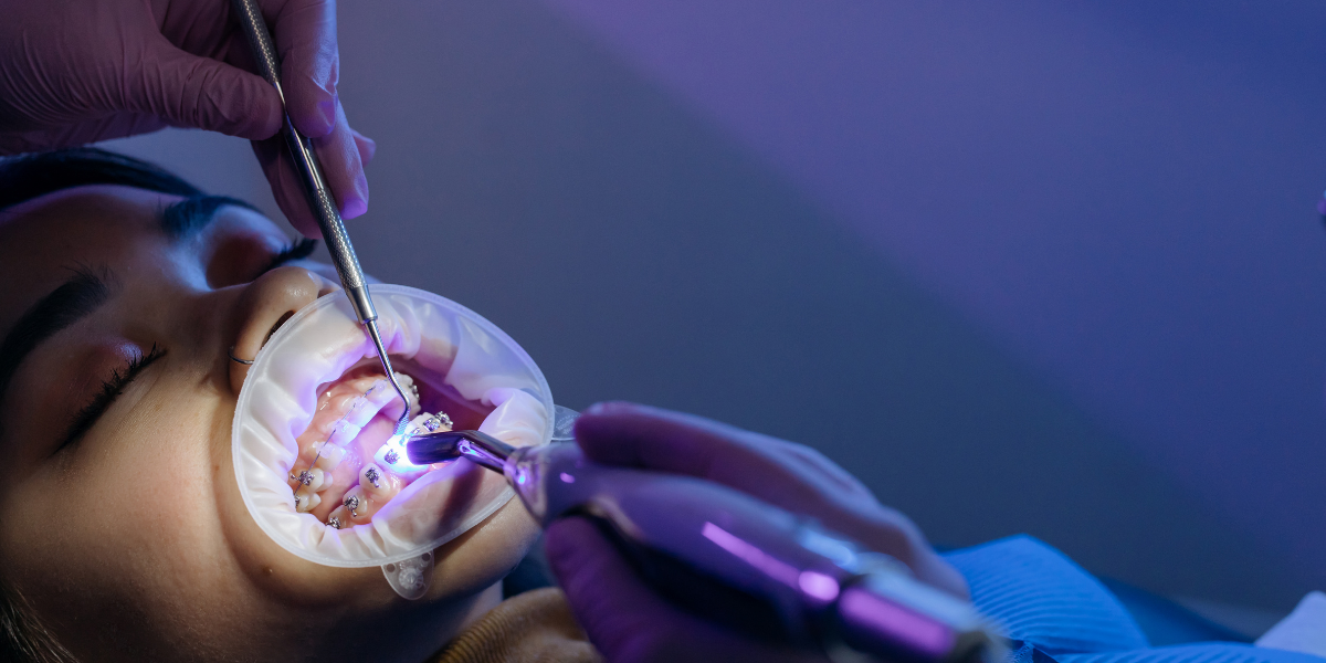 Emergency Orthodontic Care in Paterson