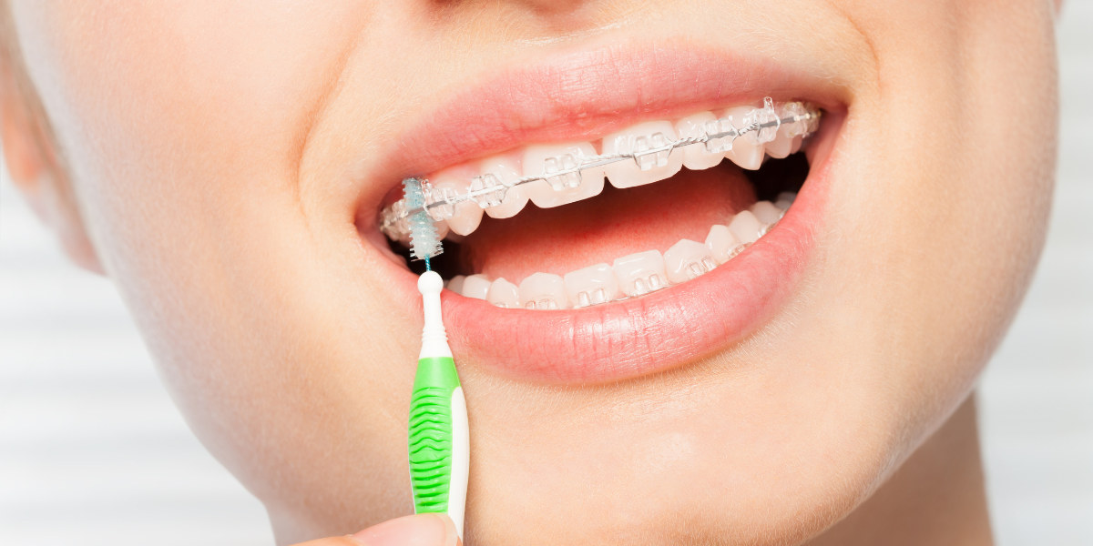Making Orthodontic Care Work with a Busy Schedule