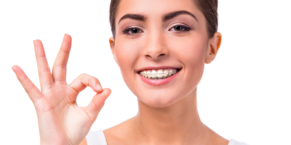 The Long-Term Reality: Can Braces Actually Improve Speech?