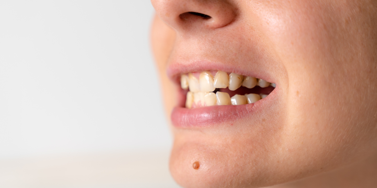 Benefit from Treatment