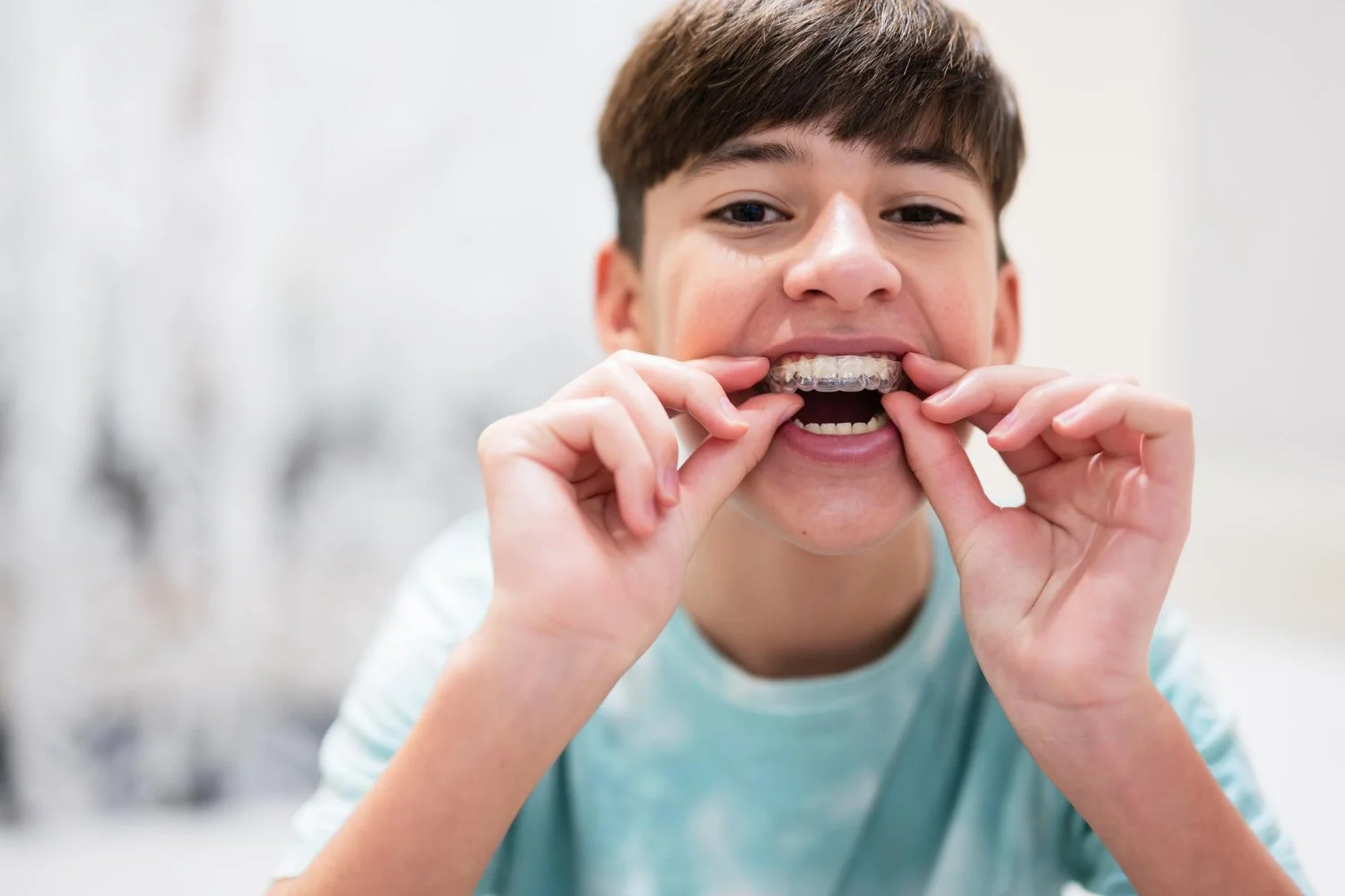 A young boy showing off his clear braces on his teeth while holding them with his fingers.