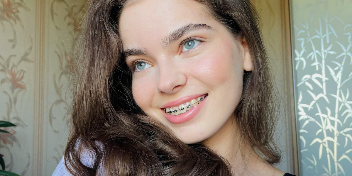 So, How Long Do Braces Usually Take