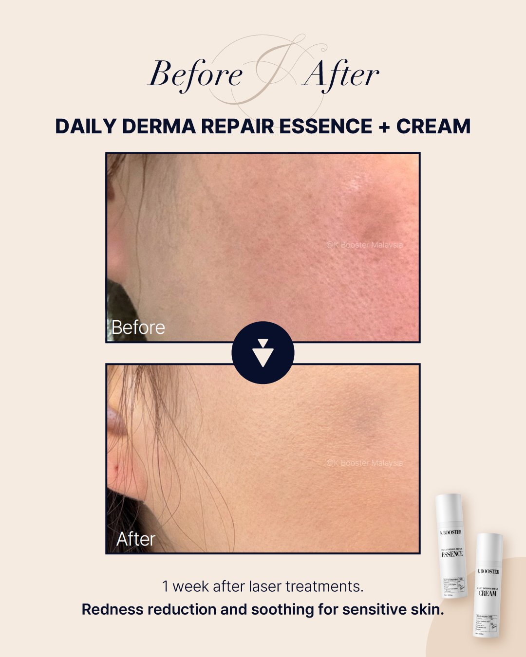 KB-Essence+Cream.jpg