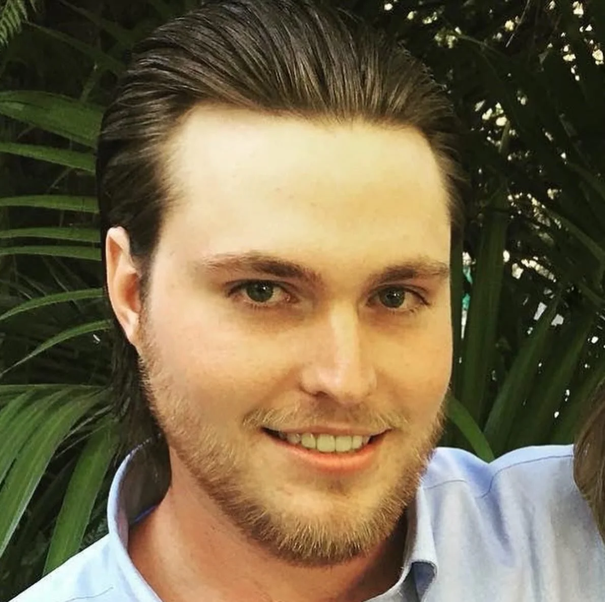 &ldquo;Charlie (Griswold) always told me he was too smart to do a bad drug. He died July 27, 2022 from a fentanyl-laced drug.

For those of us who witnessed his pain, we knew that when he made it to beyond the pain, he was going to have an incredible