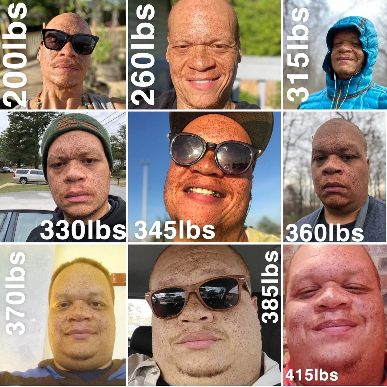 Collage of nine photos showing the same man at different weights, with text indicating his weight in pounds for each photo, ranging from 200 to 415 pounds.