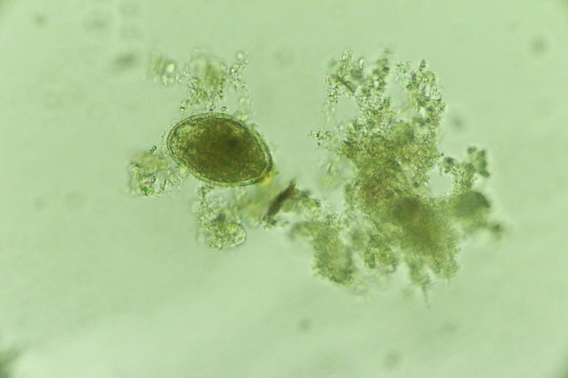 Worm Testing — GYST