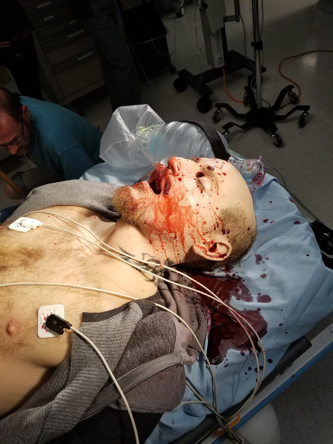 Simulation médicale montrant un mannequin ensanglanté sur un lit d'hôpital avec des électrodes et un masque à oxygène, entouré de personnel médical.