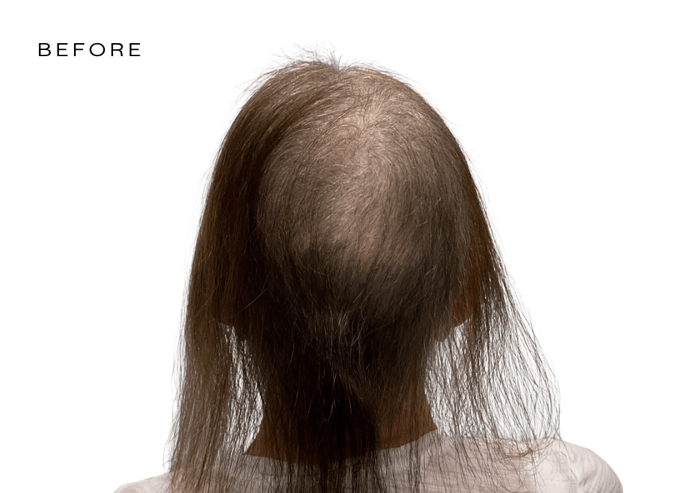 female hair loss experts near me