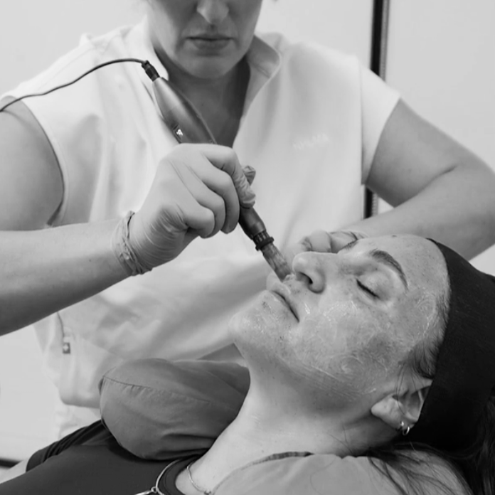 Microneedling Special (Save Up To $400)