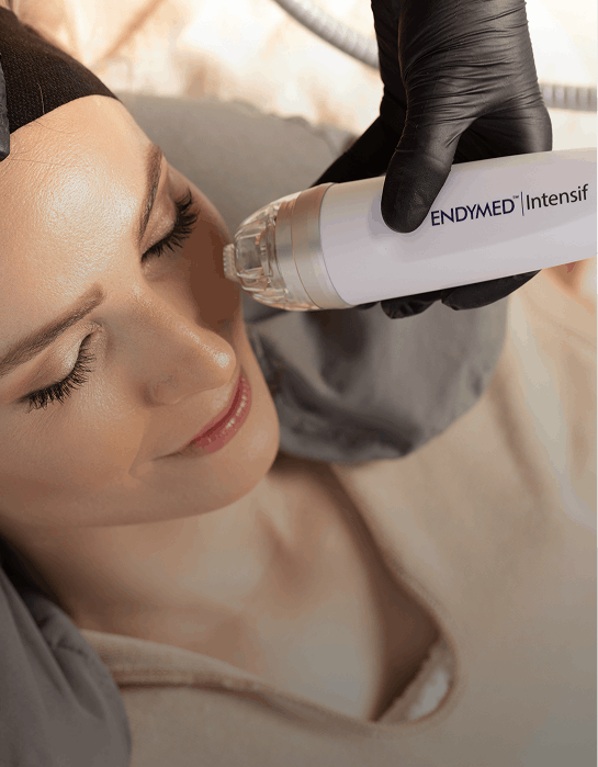 microneedling scottsdale