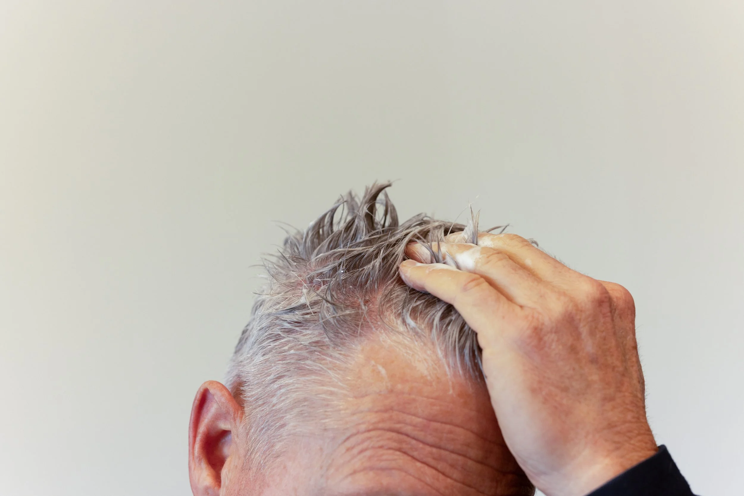 scalp scrub for hair loss.jpg