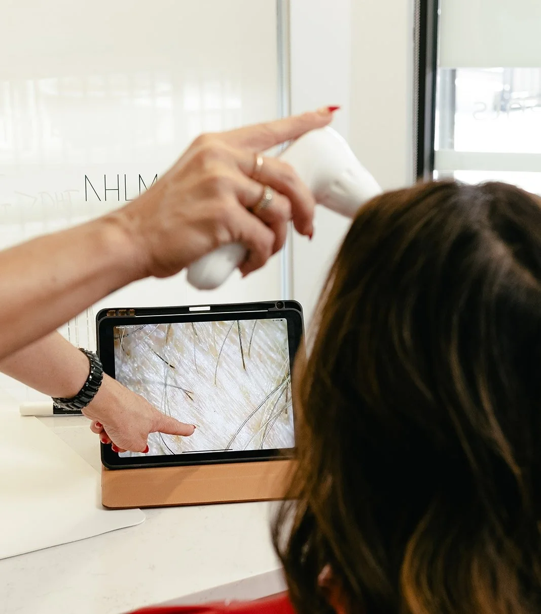 Become a Hair Loss Specialist: Your Next Business Opportunity Starts Here