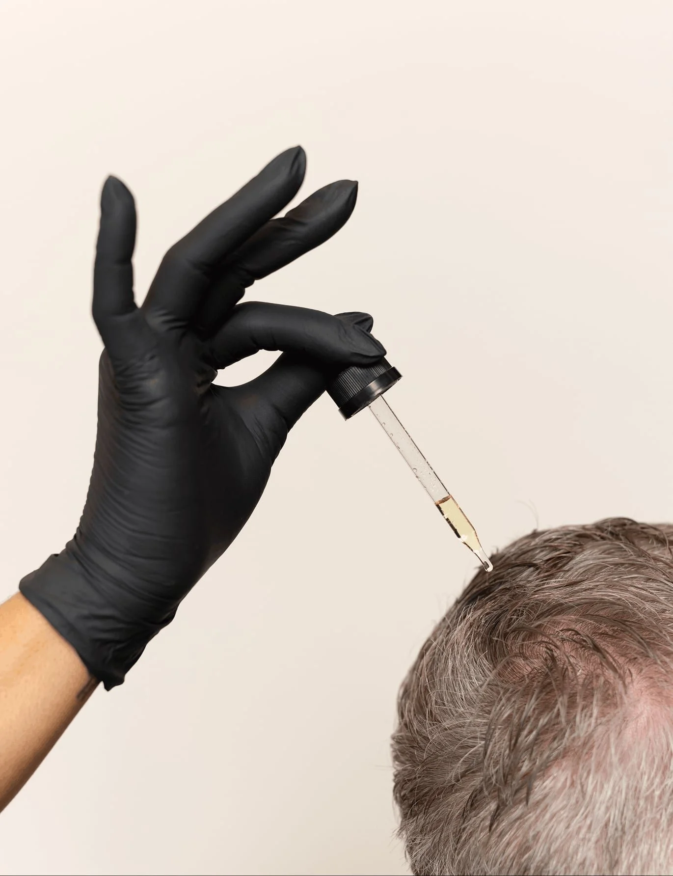 non-surgical hair treatments.jpg