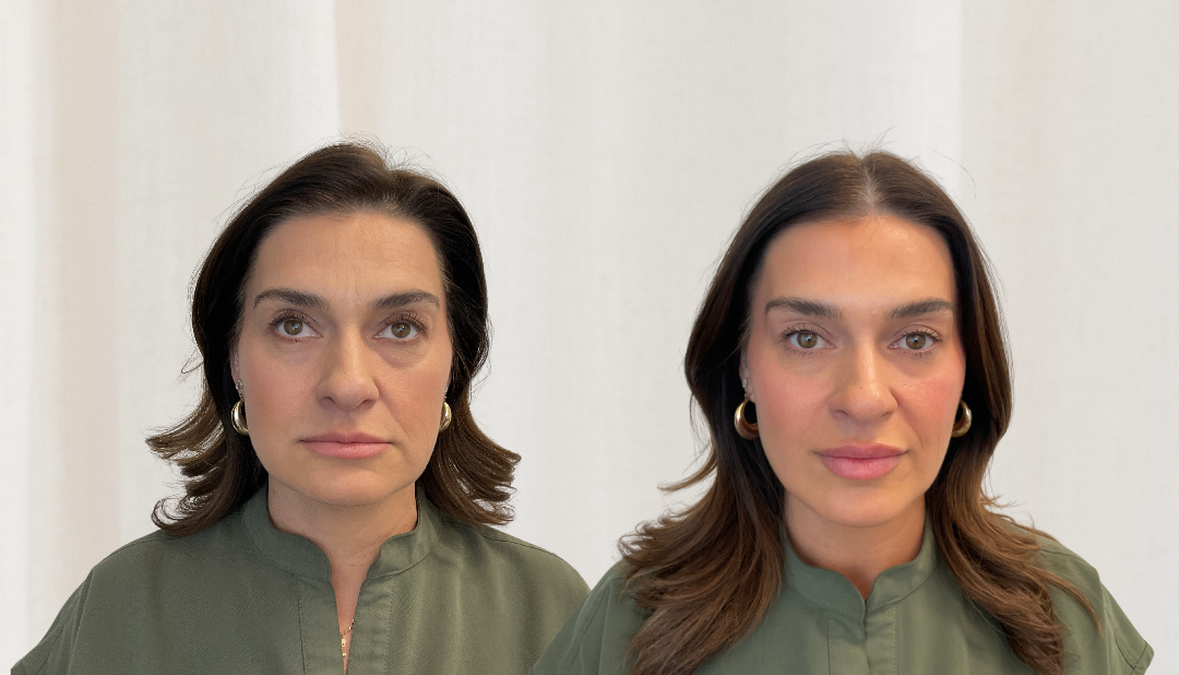 best botox in scottsdale at NHLMA