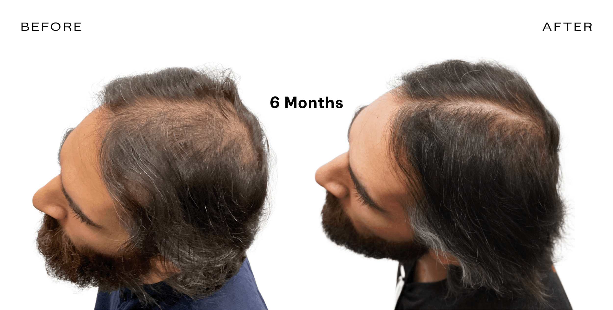 before and after hair loss arizona4.png