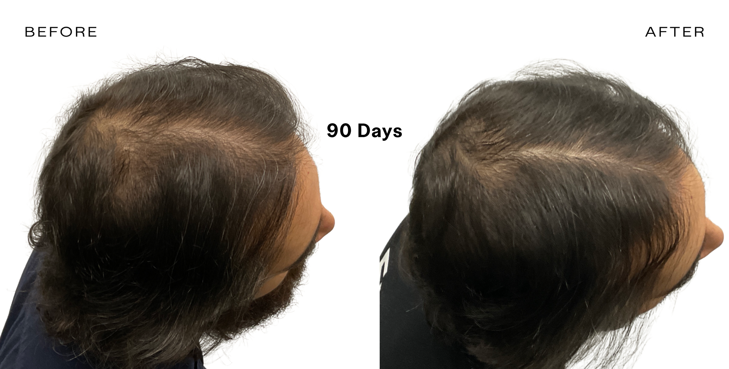 BEFORE (4).png