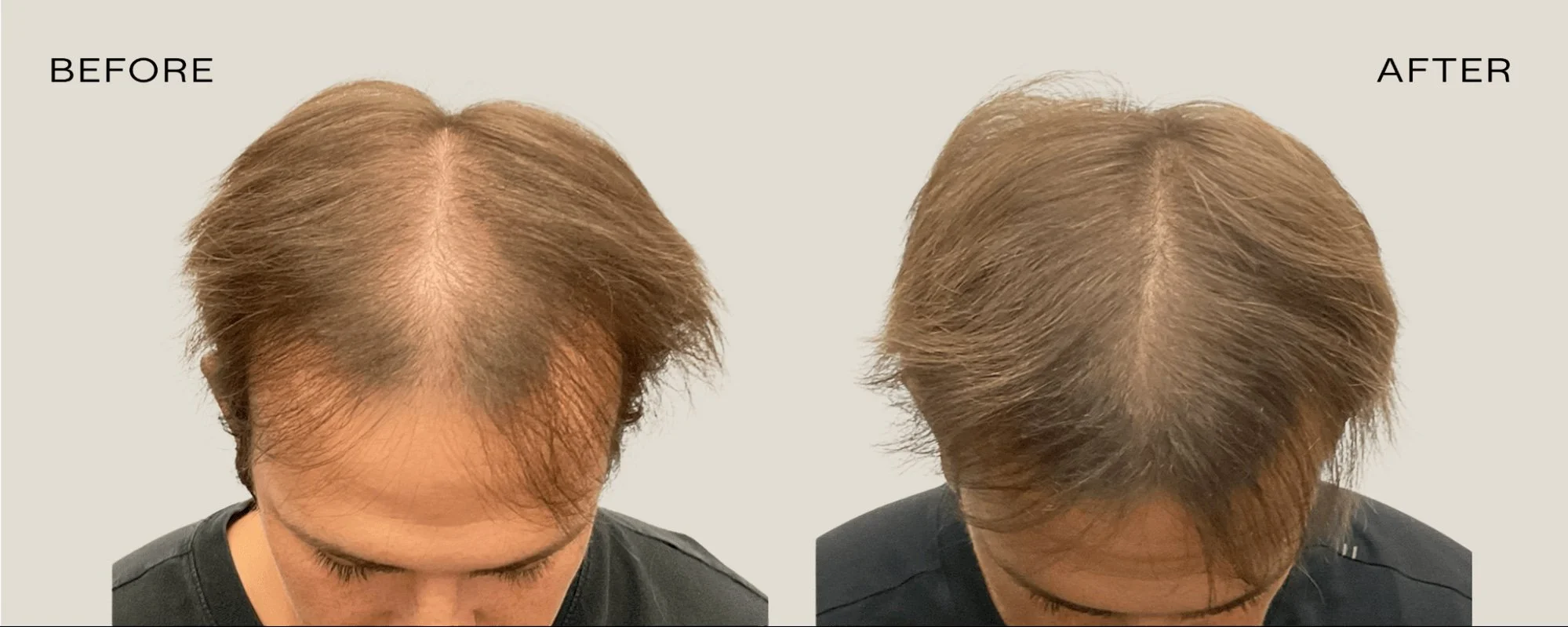 90 Days Client Hair Growth Transformation
