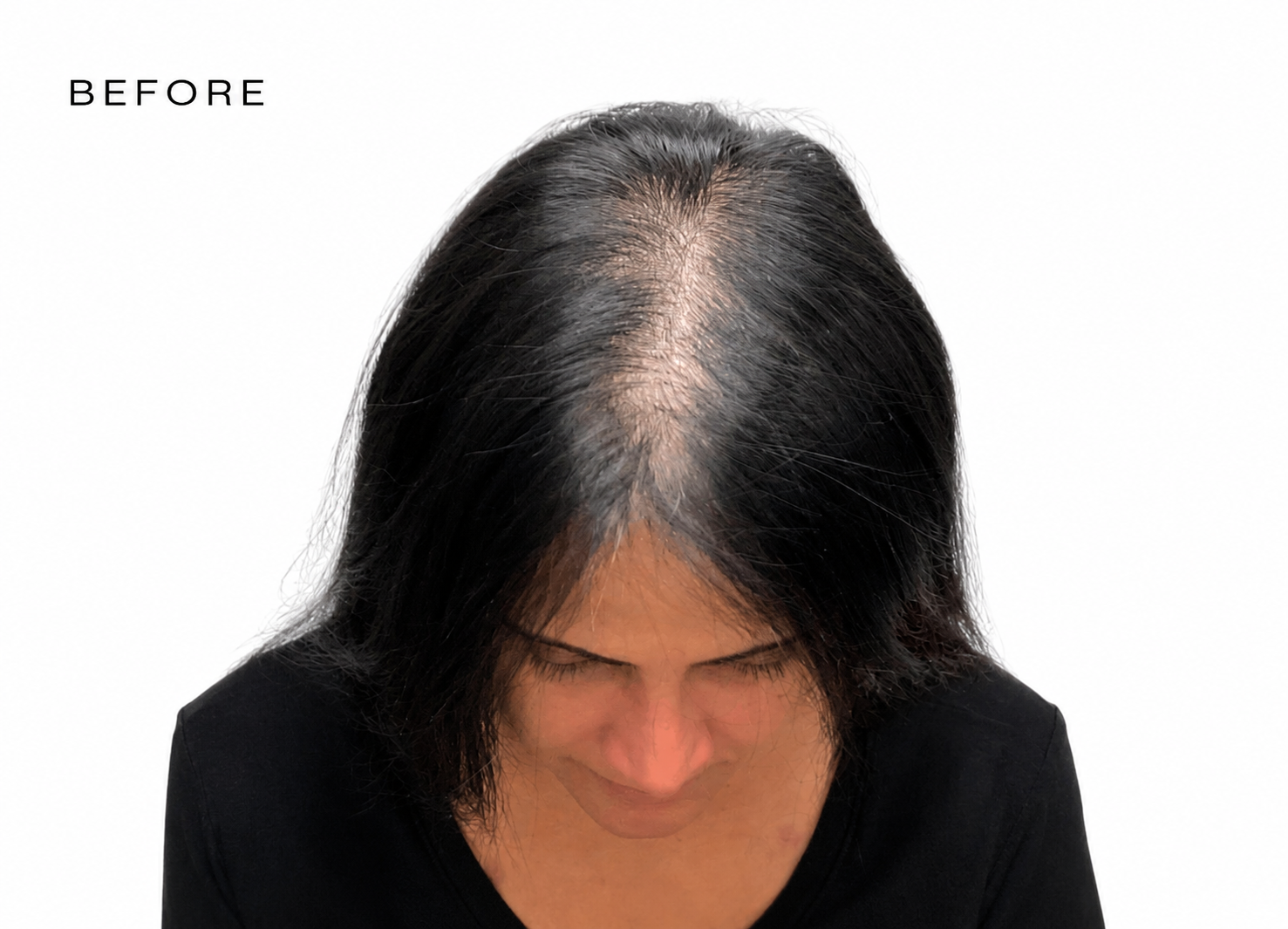 hair loss experts scottsdale