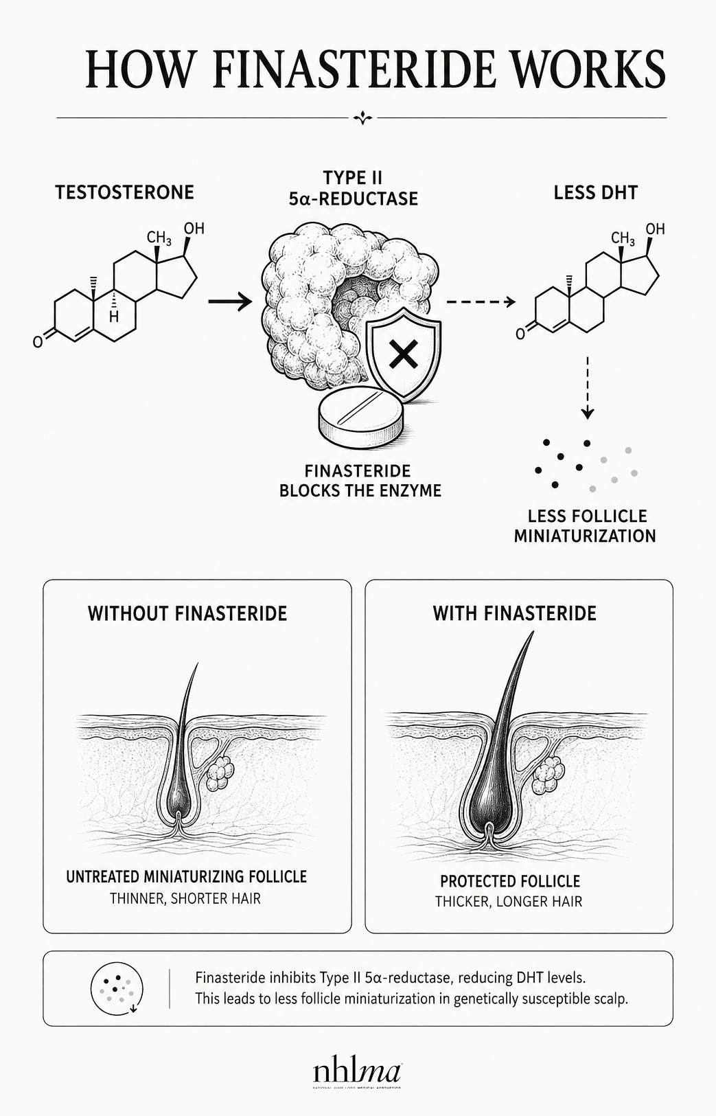 How Finasteride Works diagram