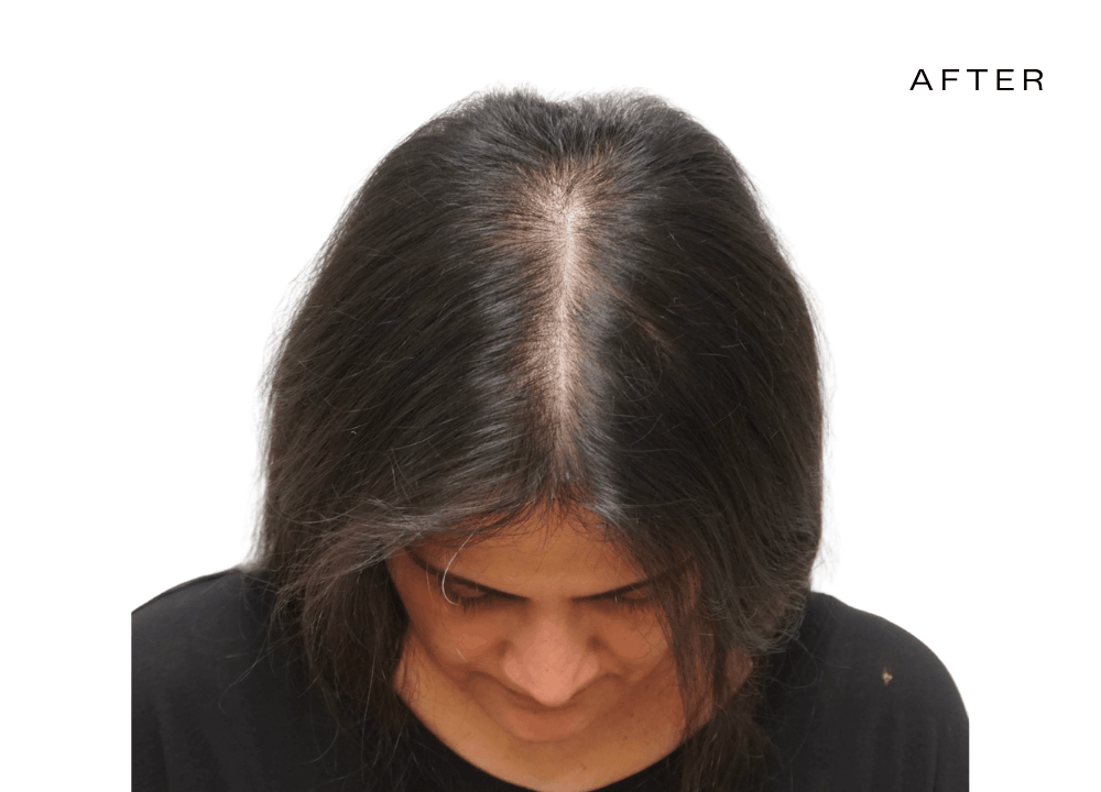 hair loss experts for women